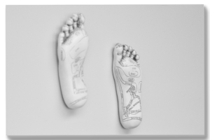 PhysioWell Health Solutions Reflexology Treatment Areas on Foot image